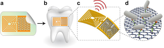 tooth sensor